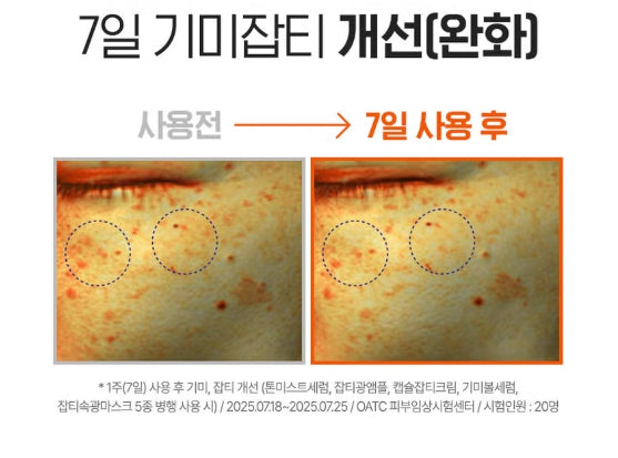 Liposome Vitamin C Blemish Ampoule 30ml